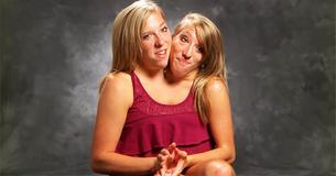 Des sœurs siamoises , Abby et Brittany Hensel, sont embauchées comme professeurs de mathématiques au Minnesota.