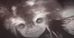 Une mère est choquée et fascinée par le visage de son bébé à naître sur une échographie.