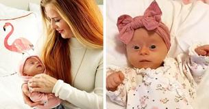 Une maman pour la première fois a publié un avis sur sa magnifique fille atteinte du syndrome de Down