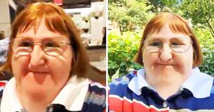 Einer Frau mit einer genetischen Störung wird gesagt, sie sei "zu hässlich", um Bilder zu posten – also schlägt sie mit Selfies zurück