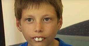 Des camarades se moquent d'un garçon à cause de ses dents, alors des donateurs lui offrent 100 000$ pour lui donner un sourire éclatant