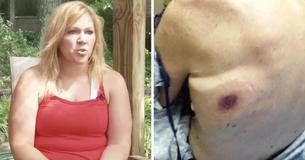 Vader sterft 48 uur na besmetting met vleesetende bacteriën in Florida - Dochter waarschuwt iedereen