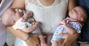 Vrouw bevalt van tweeling met twee verschillende vaders en ze zijn allebei 'in de wolken'