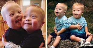 Tweeling met Downsyndroom gebruikt sociale media om vreugde en bewustzijn te verspreiden