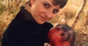 Ein Baby soll wegen einer seltenen Hautkrankheit versteckt werden, durch die sich die Haut 10 Mal schneller als normal schält