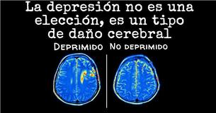 ¡Nuevas investigaciones demuestran que la depresión causa daño cerebral, no al revés!