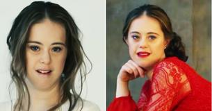 Een turnkampioen met downsyndroom wordt nu een model terwijl ze stereotypes neerhaalt
