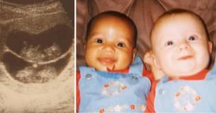 Une maman donne naissance à des jumeaux, mais d'autres refusent de croire qu'ils sont jumeaux à cause de leur apparence