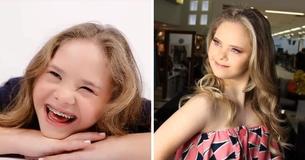 14-jarig meisje met downsyndroom uit Brazilië werd gecontracteerd door 5 modellenbureaus
