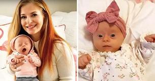Une mère fait une "revue" sur sa fille de 2 mois atteinte du syndrome de la trisomie