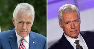 Alex Trebek fornisce gli aggiornamenti sulla sua salute dicendo che si sente "spento" e che ha perso i capelli, mentre questa difficile battaglia contro il cancro lo butta giù