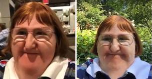 Gehandicapte vrouw werd verteld dat ze "te lelijk" is om selfies te maken maar weigert om gepest te worden door negatieve berichten