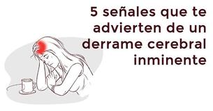 5 señales que te advierten de un derrame cerebral inminente