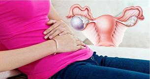 6 síntomas alarmantes de los quistes ováricos que toda mujer debe conocer
