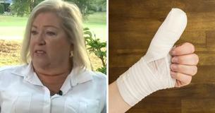 Woman Contracts Flesh-Eating Bacteria And Nearly Loses Arm After Visit To Nail Salon