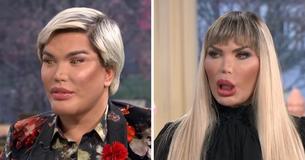"Human Ken Doll" se révèle être transsexuel et choisit de vivre en tant que femme