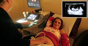Sue Radford, mère de 21 enfants, vient d'annoncer qu'elle va bientôt accueillir son 22ème enfant