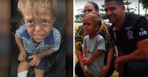 Un enfant de neuf ans harcelé à cause de son nanisme est largement soutenu sur les réseaux sociaux
