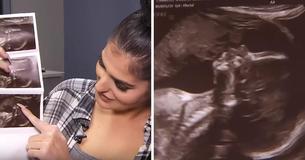 Une femme enceinte voit son défunt père embrasser sa fille sur une échographie de grossesse