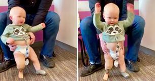 Un enfant d'un an né avec une seule jambe danse avec joie après que sa prothèse lui ait permis de marcher