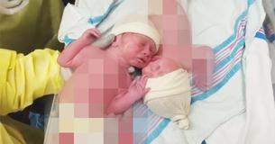 Quelques instants après l'accouchement, des jumeaux nouveau-nés fascinent les gens et font courir leur père pour la caméra