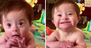 Bebé con síndrome de Down se gana la atención de todos luego de mostrarle una gran sonrisa a su madre adoptiva