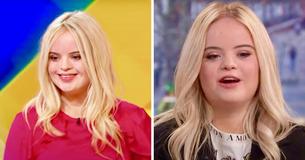 Un superbe mannequin atteint du syndrome de Down devient le visage d'une marque de cosmétiques