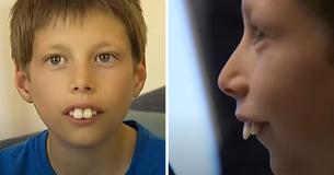 Un garçon victime de moqueries pour ses dents retrouve le sourire avec l'aide de sa généreuse communauté