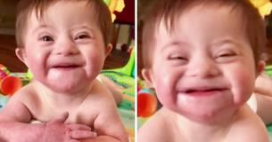 Une adorable petite fille trisomique fait un tabac en souriant à sa nouvelle mère adoptive