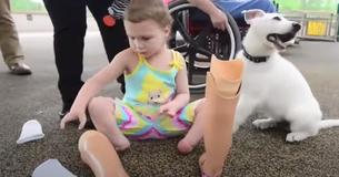 Toddler Born Missing Feet Gets Puppy Born With Missing Paw