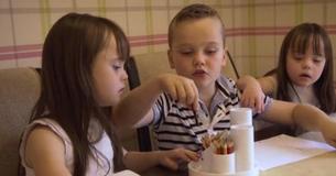 Twins With Down Syndrome Are One In A Million