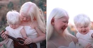 Des sœurs albinos avec une différence d'âge de douze ans se font connaître sur Internet grâce à leurs photos de mannequins