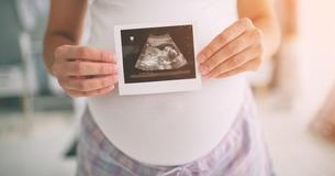 Blind Parents Are Able To Feel Unborn Baby’s Face Thanks To New 3D Technology