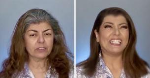 Les gens ont dit au docteur qu'elle était laide et stupide - Elle a le dernier mot avec son relooking