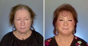 Vrouw met dunner wordend haar voelt zich weer gezien na make-over