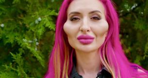 Socialemedia-influencer met de ‘grootste wangen’ beweert dat ze ze nog groter wil
