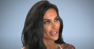 Une accroc à la chirurgie plastique appelée « Plastic Barbie » dépense 74 000 $ en chirurgie