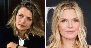 Ageless Michelle Pfeiffer, 63, Opens Up Regarding Plastic Surgery Thoughts