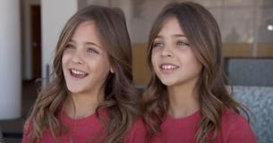 Vor einem Jahrzehnt wurden sie als die hübschesten Zwillingsschwestern der Geschichte bezeichnet - jetzt sind sie bald Teenager