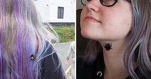 Teenager Adopts Bumblebee Which Sleeps Next To Her And Follows Her To Stores