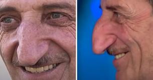 Man, 71, Holds Record For World's Longest Nose — And It's Only Getting Bigger