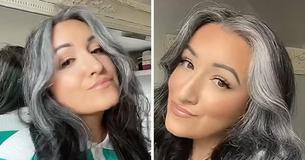 Woman Gray At 31 Says She Used To Feel 'Ashamed,' Now Has Embraced Change