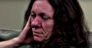 L'intervention chirurgicale sur le nez de cette femme a complètement transformé son apparence et a changé sa vie