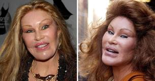 Einblicke in das Leben von Jocelyn Wildenstein, der Milliardärin, die als "Catwoman" bekannt ist