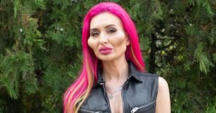 Model mit den "größten Wangen der Welt" zeigt, wie sie vor der Verwandlung aussah
