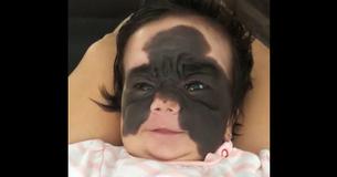 Girl Has Rare Tumor Removed Thanks To Innovative Surgery
