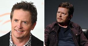 Michael J. Fox Says That It’s ‘Weird’ That He Has Done So Well As He Refers To His Parkinson’s Disease