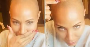 Jada Pinkett Smith Says Her And Alopecia "Will Be Friends" As She Gives Insight Into Life With The Disease