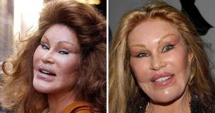 Inside The Life Of Jocelyn Wildenstein, The Billionaire Socialite Known As ‘Catwoman’