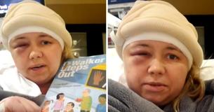 Teacher Reads To Students From Hospital A Day After Surgeons Remove Tumor